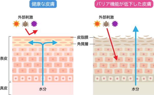 かゆみのメカニズムを解説