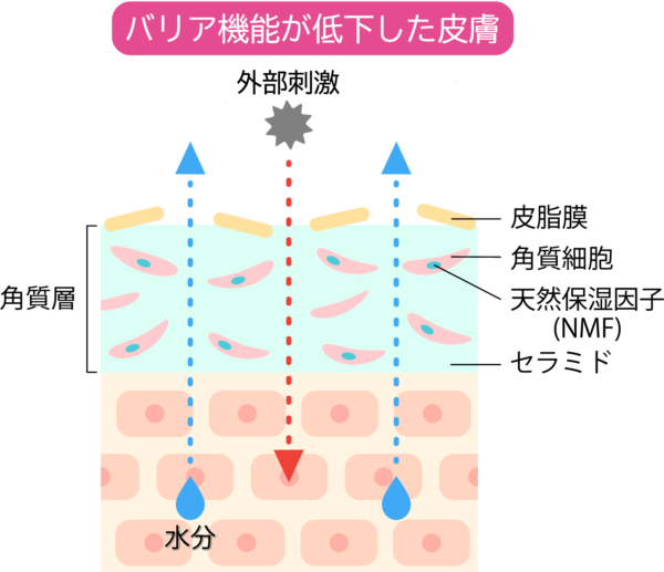 バリア機能が低下した皮膚